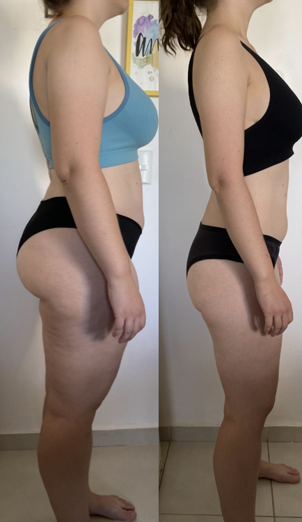 Client transformation — side view